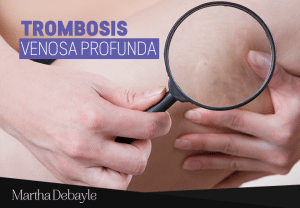 Trombosis venosa profunda