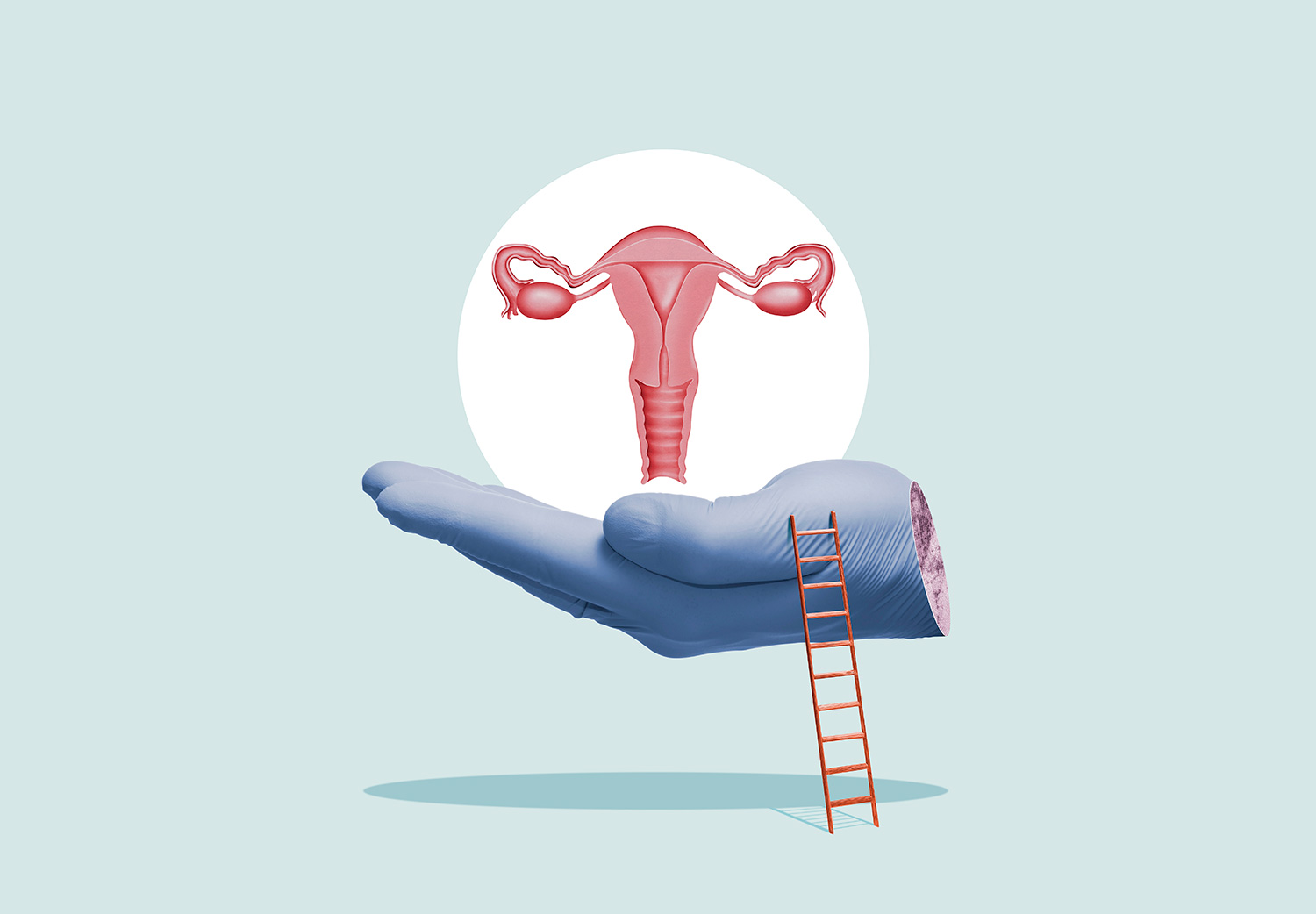 todo sobre el cáncer de ovario y cómo prevenirlo