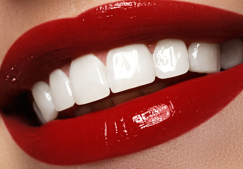 ¿Qué onda con el blanqueamiento dental?