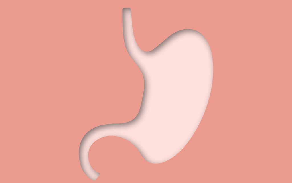 enfermedad de Crohn sintomas y tratamientos