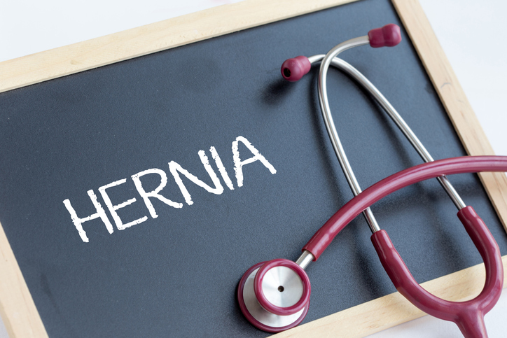 cuáles son las hernias más comunes