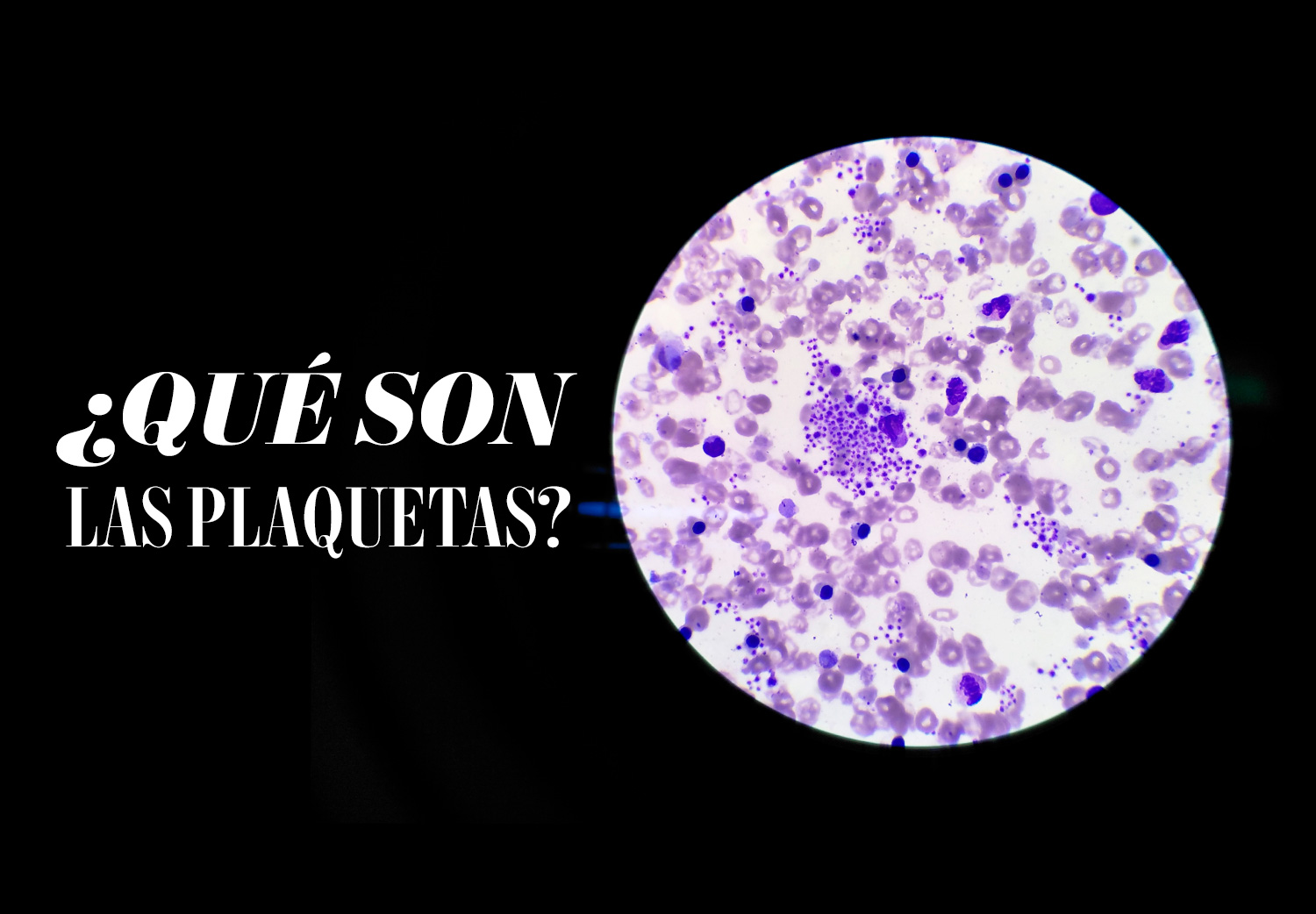 qué son las plaquetas