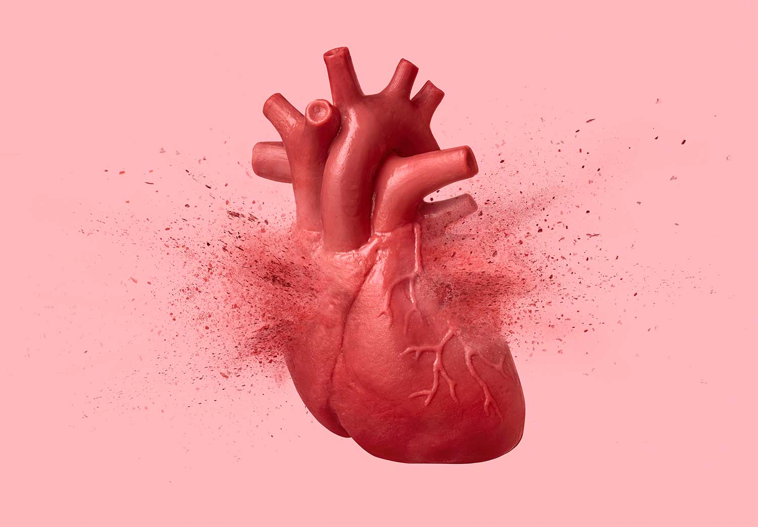 paro-cardiaco-en-jovenes-covid-19