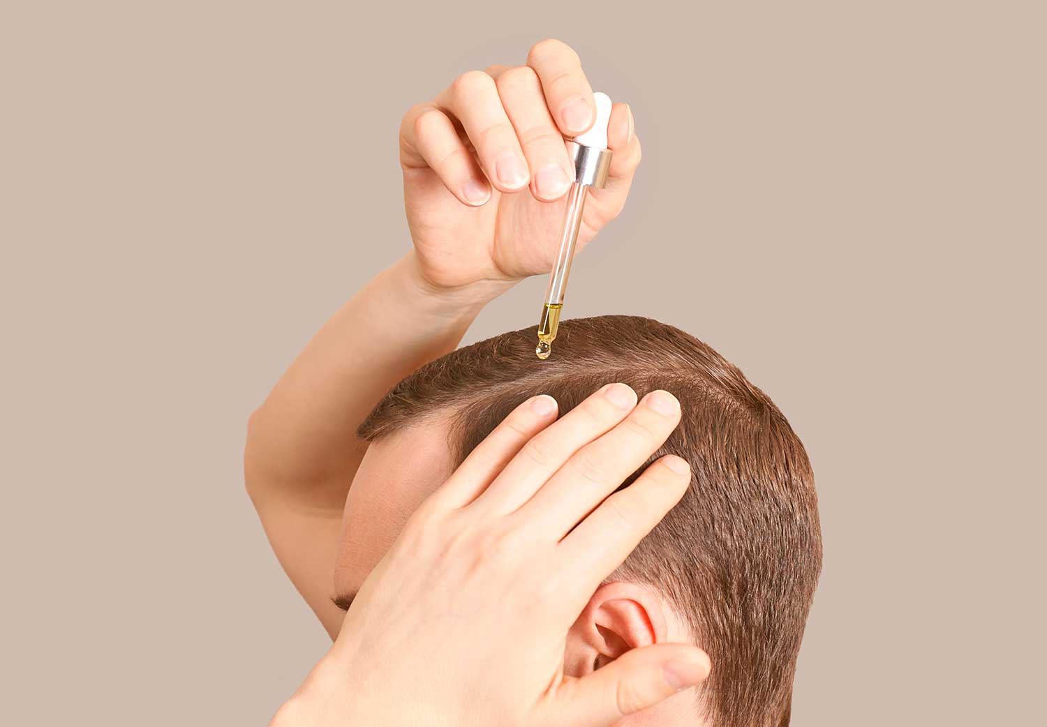 el-refresco-te-tira-el-pelo-calvicie-masculina