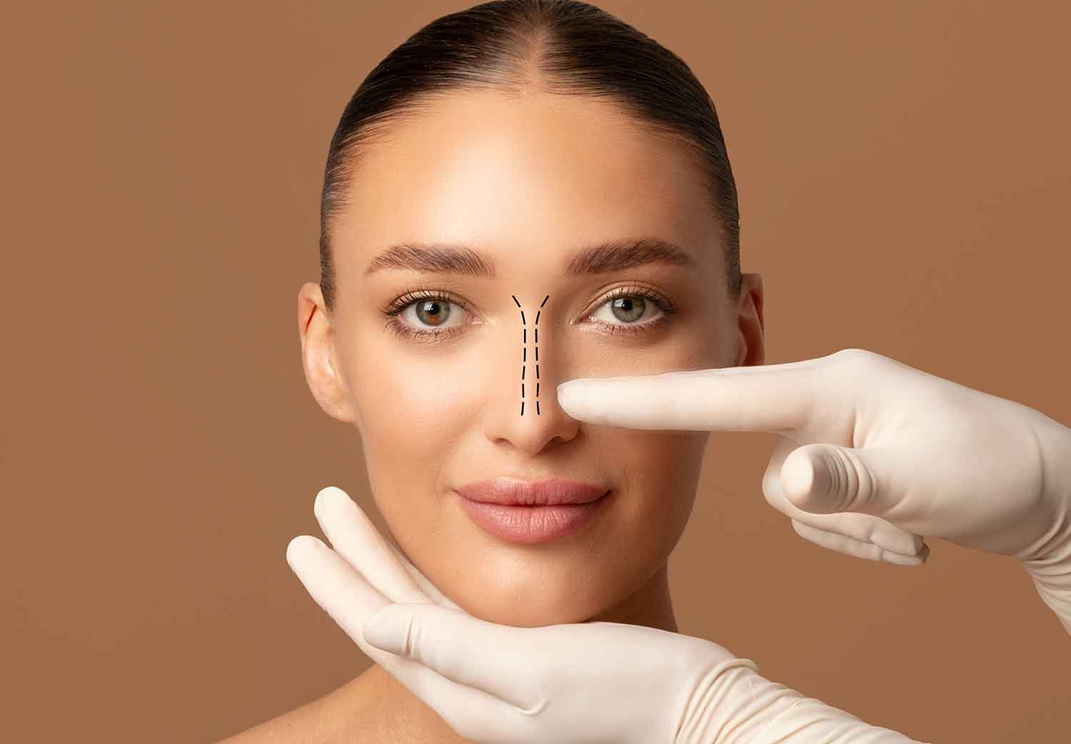 revertir-un-mal-resultado-en-una-rinoplastia